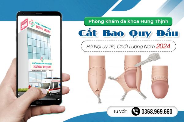 Địa Chỉ Cắt Bao Quy Đầu Hà Nội Uy Tín, Chất Lượng Năm 2024