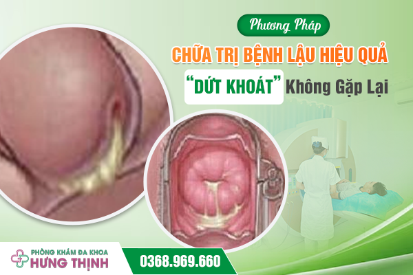 Phương Pháp Chữa Trị Bệnh Lậu Hiệu Quả, “Dứt Khoát” Không Gặp Lại