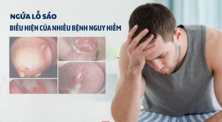 Ngứa lỗ sáo ở nam giới - Biểu hiện của nhiều bệnh nguy hiểm