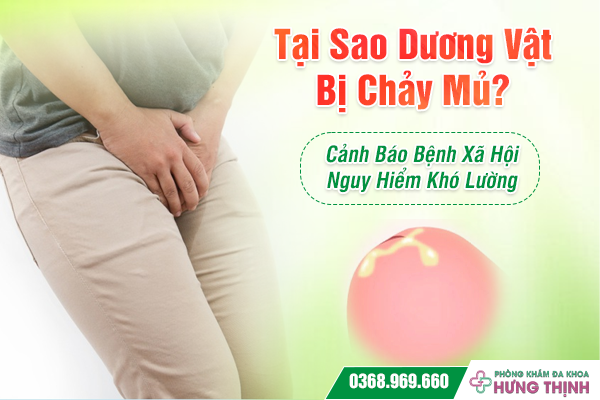 Tại Sao Dương Vật Bị Chảy Mủ? Cảnh Báo Bệnh Xã Hội Nguy Hiểm Khó Lường