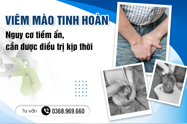 Viêm mào tinh hoàn: Nguy cơ tiềm ẩn, cần được điều trị kịp thời 