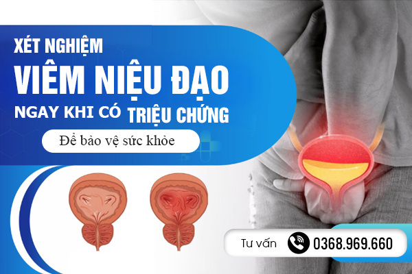 Xét nghiệm viêm niệu đạo ngay khi có triệu chứng để bảo vệ sức khỏe