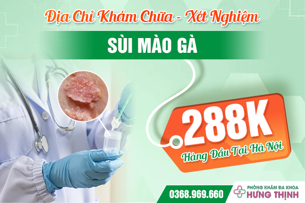 Địa Chỉ Khám Chữa - Xét Nghiệm Sùi Mào Gà 288K Hàng Đầu Tại Hà Nội