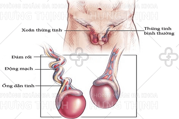 Khám sinh dục nam như thế nào