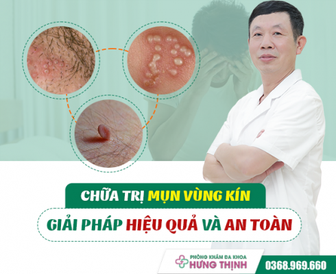 Chữa trị mụn vùng kín: Giải pháp hiệu quả và an toàn 