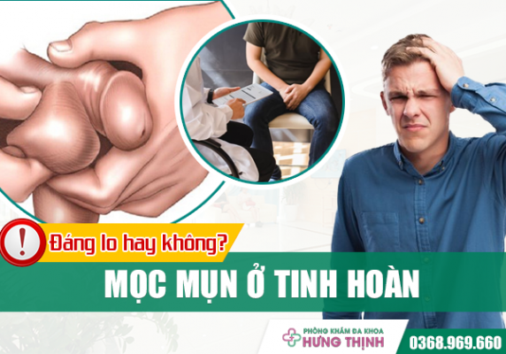 Hoang mang khi mọc mụn ở tinh hoàn: Đáng lo hay không?