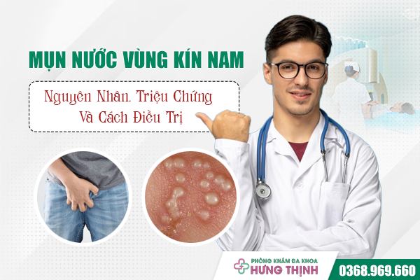 Mụn Nước Vùng Kín Nam: Nguyên Nhân, Triệu Chứng Và Cách Điều Trị