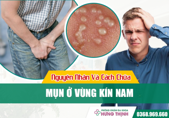 Mụn Ở Vùng Kín Nam Là Bệnh Gì? Nguyên Nhân Và Cách Chữa