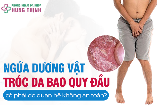 Ngứa Dương Vật, Tróc Da Bao Quy Đầu Có Phải Do Quan Hệ Không An Toàn?