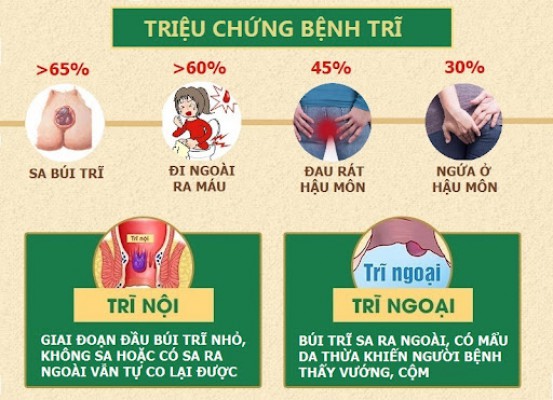 Bệnh trĩ là gì? - Dấu hiệu bị trĩ - Nhận biết sớm để điều trị kịp thời