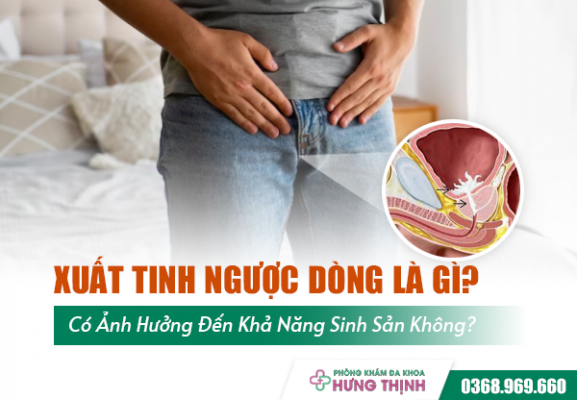 Xuất Tinh Ngược Dòng Là Gì? Có Ảnh Hưởng Đến Khả Năng Sinh Sản Không?