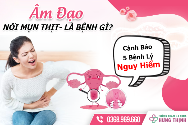 Âm Đạo Bị Nổi Mụn Thịt Là Bệnh Gì? Cảnh Báo 3 Bệnh Lý Nguy Hiểm Không Thể Chủ Quan