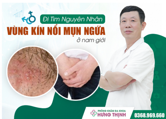 Đi Tìm Nguyên Nhân Vùng Kín Nam Nổi Mụn Ngứa