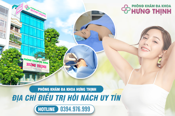 Địa Chỉ Chữa Hôi Nách An Toàn, Uy Tín Tại Hà Nội 