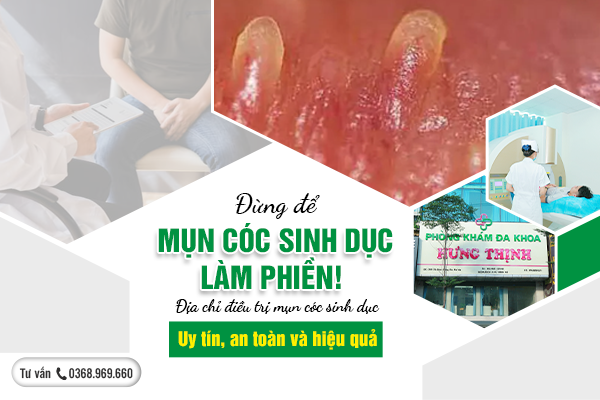 Đừng để mụn cóc sinh dục làm phiền! Địa chỉ điều trị mụn cóc sinh dục uy tín, an toàn và hiệu quả.